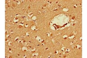 Immunohistochemistry of paraffin-embedded human brain tissue using ABIN7152586 at dilution of 1:100