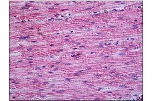 Human Intestine, Muscularis Propria: Formalin-Fixed, Paraffin-Embedded (FFPE) (PPP3CA antibody  (N-Term))