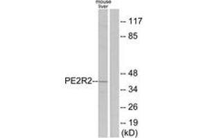Western blot analysis of extracts from mouse liver cells, using PE2R2 Antibody.
