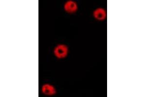 ABIN6275446 staining HepG2 by IF/ICC. (GFR antibody  (C-Term))
