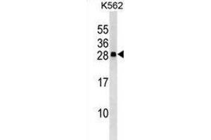 Western blot analysis in K562 cell line lysates (35ug/lane) using CXXC4 Antibody .