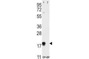 Western Blotting (WB) image for anti-CD90 (THY1) antibody (ABIN3001433)