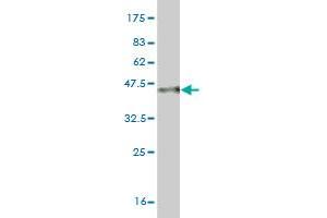 Western Blot detection against Immunogen (35. (MYO3A antibody  (AA 1400-1490))