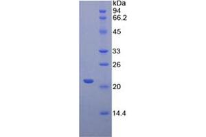 SDS-PAGE analysis of Mouse CD8b Protein. (CD8B Protein)