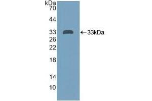 Detection of Recombinant PTPRH, Human using Polyclonal Antibody to Protein Tyrosine Phosphatase Receptor Type H (PTPRH) (PTPRH antibody  (AA 844-1096))