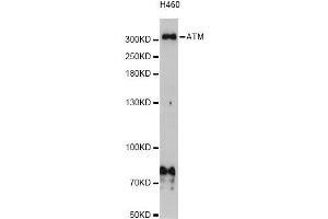 Western blot analysis of extracts of H460 cells, using ATM Antibody (ABIN5973499) at 1/1000 dilution. (ATM antibody)