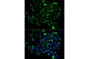 Immunofluorescence analysis of A549 cells using EEF1B2 antibody (ABIN5973953). (EEF1B2 antibody)