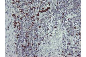 Image no. 2 for anti-Peptidyl Arginine Deiminase, Type IV (PADI4) (AA 299-588) antibody (ABIN1491357) (PAD4 antibody  (AA 299-588))