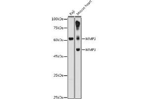 Western blot analysis of extracts of various cell lines, using MMP3 antibody (ABIN3021708, ABIN3021709, ABIN3021710 and ABIN6215578) at 1:1000 dilution. (MMP3 antibody  (AA 248-477))