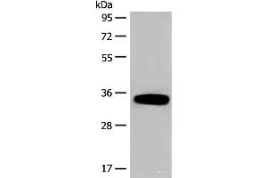 Western blot analysis of Human fetal liver tissue lysate using DHRS1 Polyclonal Antibody at dilution of 1:400 (DHRS1 antibody)