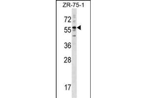 KRT3 Antibody (Center) (ABIN1538406 and ABIN2848455) western blot analysis in ZR-75-1 cell line lysates (35 μg/lane). (Keratin 3 antibody  (AA 414-441))