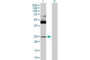 Western Blot analysis of MAX expression in transfected 293T cell line by MAX MaxPab polyclonal antibody. (MAX antibody  (AA 1-151))