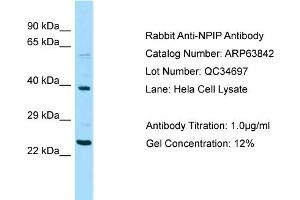 Western Blotting (WB) image for anti-Nuclear Pore Complex Interacting Protein Family, Member A1 (NPIPA1) (Middle Region) antibody (ABIN2789641) (NPIPA1 antibody  (Middle Region))