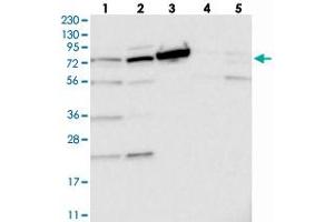 Western blot analysis of Lane 1: RT-4, Lane 2: U-251 MG, Lane 3: Human Plasma, Lane 4: Liver, Lane 5: Tonsil with TOP1MT polyclonal antibody .