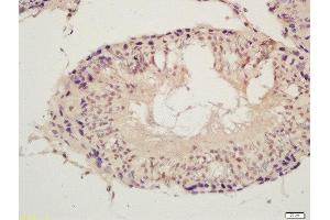 Formalin-fixed and paraffin embedded rat testis labeled with Rabbit Anti-SPDYA Polyclonal Antibody, Unconjugated (ABIN872729) at 1:200 followed by conjugation to the secondary antibody and DAB staining