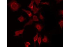 ABIN6275518 staining K562 by IF/ICC. (DVL2 antibody  (C-Term))