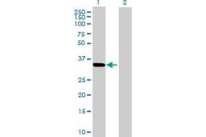 Western Blot analysis of CBR3 expression in transfected 293T cell line by CBR3 MaxPab polyclonal antibody. (CBR3 antibody  (AA 1-277))