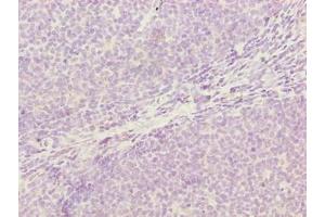 Immunohistochemistry of paraffin-embedded human tonsil tissue using ABIN7142334 at dilution of 1:100 (OXSM antibody  (AA 78-345))