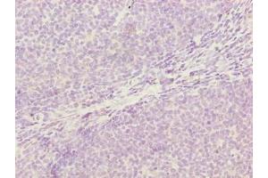Immunohistochemistry of paraffin-embedded human tonsil tissue using ABIN7142334 at dilution of 1:100
