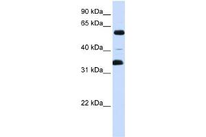 WB Suggested Anti-ZKSCAN1 Antibody Titration:  0. (ZKSCAN1 antibody  (Middle Region))