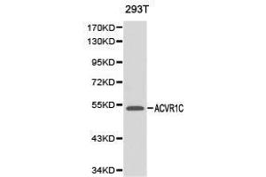 Western Blotting (WB) image for anti-Activin Receptor Type 1C (ACVR1C) antibody (ABIN1870797) (ACVR1C/ALK7 antibody)
