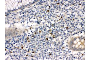 Anti- MMP8 Picoband antibody,IHC(P) IHC(P): Human Appendicitis Tissue (MMP8 antibody  (N-Term))