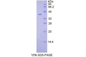 SDS-PAGE (SDS) image for Colony Stimulating Factor 2 Receptor, Beta (CSF2RB) (AA 133-233) protein (His tag,GST tag) (ABIN2122672)