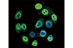 Confocal immunofluorescent analysis of phospho-SMAD4 antibody with HeLa cells followed by Alexa Fluor 488-conjugated goat anti-rabbit lgG (green). (SMAD4 antibody  (pThr277))