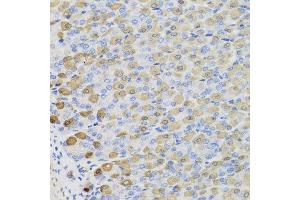 Immunohistochemistry of paraffin-embedded mouse stomach using LDHB antibody at dilution of 1:100 (x40 lens). (LDHB antibody)
