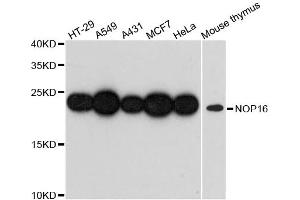 Western blot analysis of extracts of various cell lines, using NOP16 antibody (ABIN6293673) at 1:3000 dilution. (NOP16 antibody)