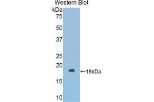 Western blot analysis of the recombinant protein. (Fascin 2 antibody  (AA 308-442))