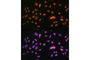 Immunofluorescence analysis of U2OS cells using NR2F2 Rabbit pAb (ABIN6133831, ABIN6144820, ABIN6144821 and ABIN6214430) at dilution of 1:100.