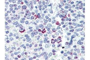 Human Spleen (formalin-fixed, paraffin-embedded) stained with LIN28Bfollowed by biotinylated goat anti-rabbit IgG secondary antibody, alkaline phosphatase-streptavidin and chromogen. (LIN28B antibody  (N-Term))