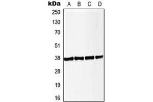 Western blot analysis of LAT (pY191) expression in HeLa PMA-treated (A), Jurkat CD3-treated (B), Raw264. (LAT antibody  (C-Term, pTyr191))