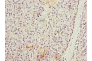 Immunohistochemistry of paraffin-embedded human pancreatic tissue using ABIN7175794 at dilution of 1:100 (WDR74 antibody  (AA 111-366))