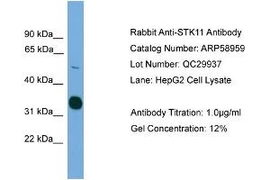 WB Suggested Anti-STK11  Antibody Titration: 0. (LKB1 antibody  (C-Term))