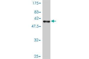 Western Blot detection against Immunogen (62. (AHSA1 antibody  (AA 1-338))