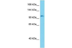 Host: Rabbit Target Name: Erc2 Sample Type: Mouse Liver lysates Antibody Dilution: 1. (ERC2 antibody  (C-Term))