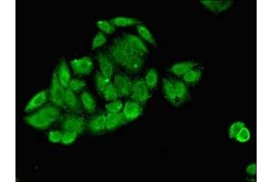 Immunofluorescent analysis of HepG2 cells using ABIN7173369 at dilution of 1:100 and Alexa Fluor 488-congugated AffiniPure Goat Anti-Rabbit IgG(H+L) (Slc25a1 antibody  (AA 144-182))