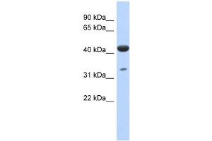 HCG_1745121 antibody used at 1 ug/ml to detect target protein. (ISPD antibody  (N-Term))