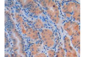 Figure. (GDF2 antibody  (AA 320-429))
