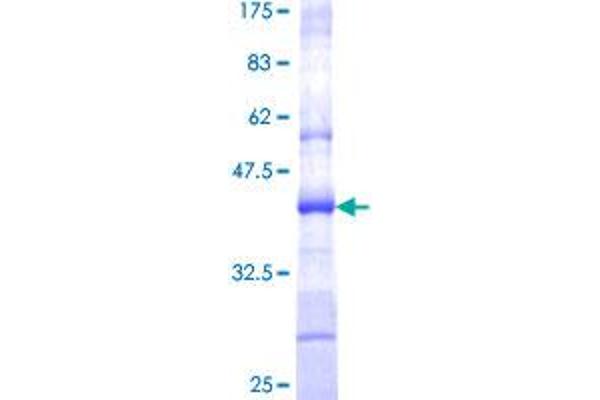 TSTA3 Protein (AA 222-321) (GST tag)