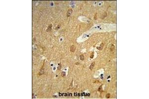 Formalin-fixed and raffin-embedded human brain tissue reacted with TSN12 Antibody (C-term), which was peroxidase-conjugated to the secondary antibody, followed by DAB staining. (TSPAN12 antibody  (C-Term))