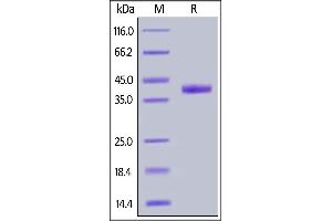 SDS-PAGE (SDS) image for Poliovirus Receptor-Related 4 (PVRL4) (AA 31-347) (Active) protein (His tag) (ABIN6938822)