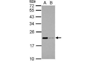 WB Image Sample (30 ug of whole cell lysate) A: THP-1 B: HL-60 12% SDS PAGE antibody diluted at 1:1000 (Apolipoprotein M antibody)