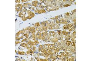 Immunohistochemistry of paraffin-embedded human stomach using ATG5 antibody (ABIN5997274) at dilution of 1/100 (40x lens).