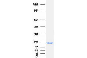 Validation with Western Blot