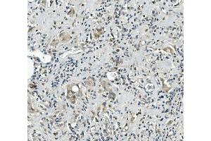 IHC analysis of Calretinin/CALB2 using anti-Calretinin/CALB2 antibody (ABIN7602106). (Calretinin antibody  (AA 59-90))