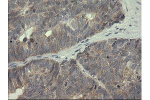 Image no. 4 for anti-serpin Peptidase Inhibitor, Clade B (Ovalbumin), Member 3 (SERPINB3) antibody (ABIN1500886)