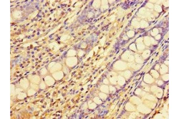 ELOVL1 antibody  (AA 82-175)